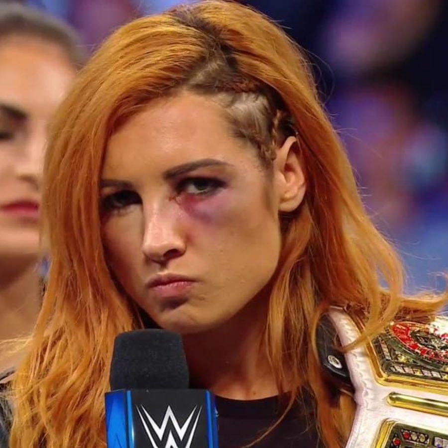 Who broke Becky Lynch's face as referenced by 29-year-old on RAW